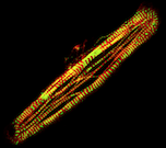 Engineering hiPSC-cardiomyocyte models